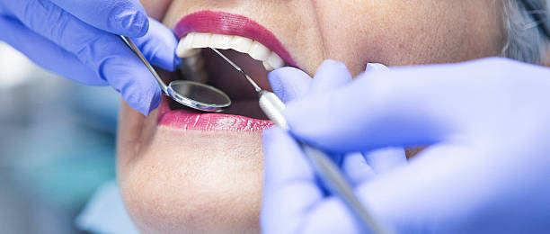 Best Knocked-Out Tooth Emergency  in Ashland, IL